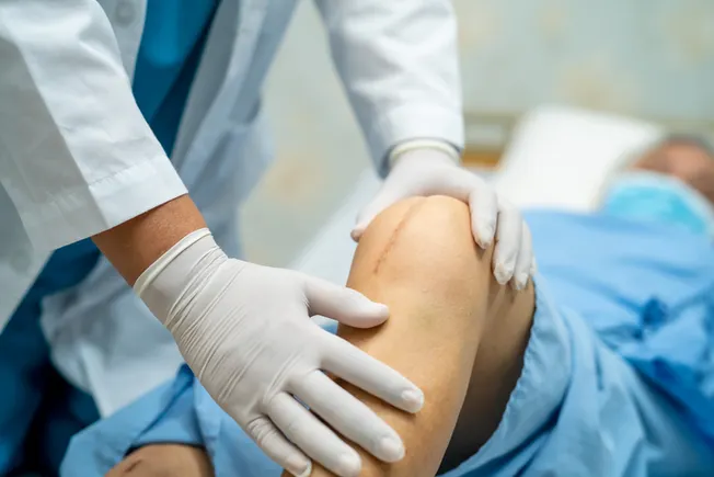 Exactech با توجه به کاشت معیوب زانو ، توافق 8 میلیون دلاری را می پذیرد