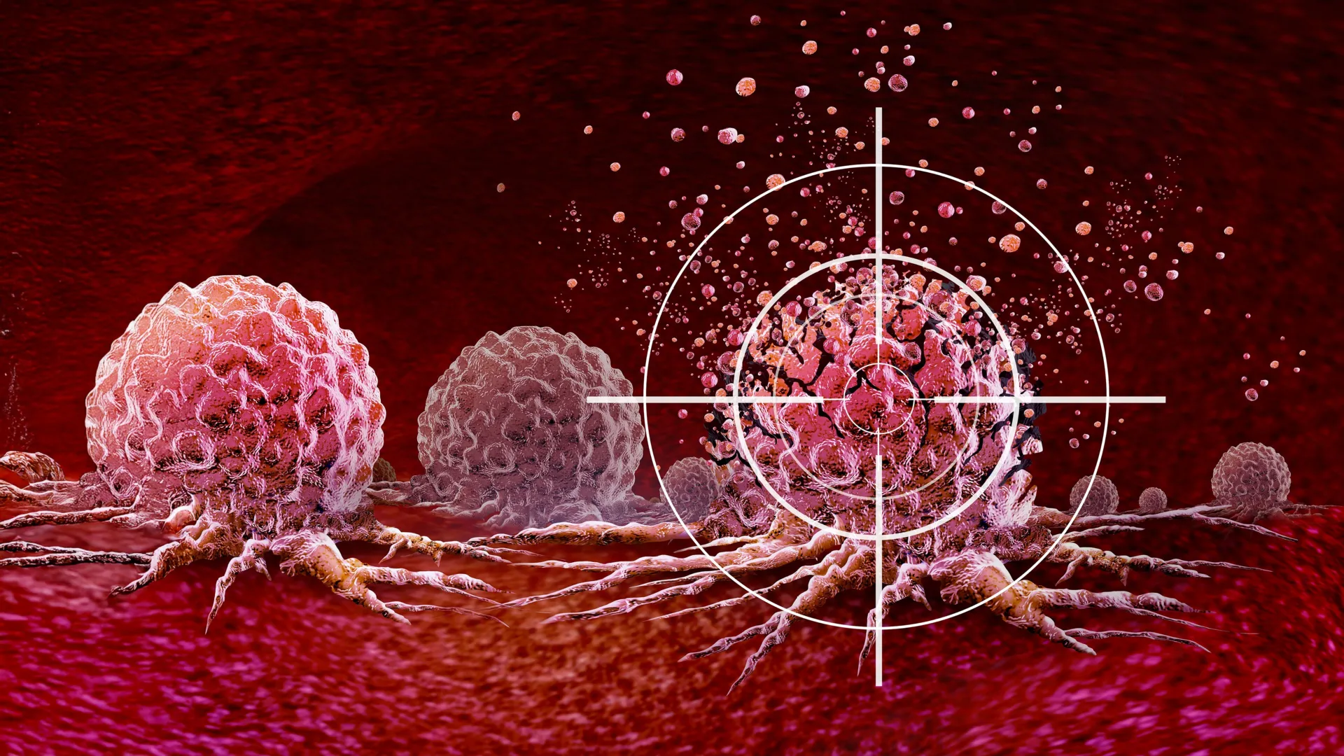 داروی هوشمند به یک نقطه ضعیف RNA پنهان در سلول های سرطانی حمله می کند